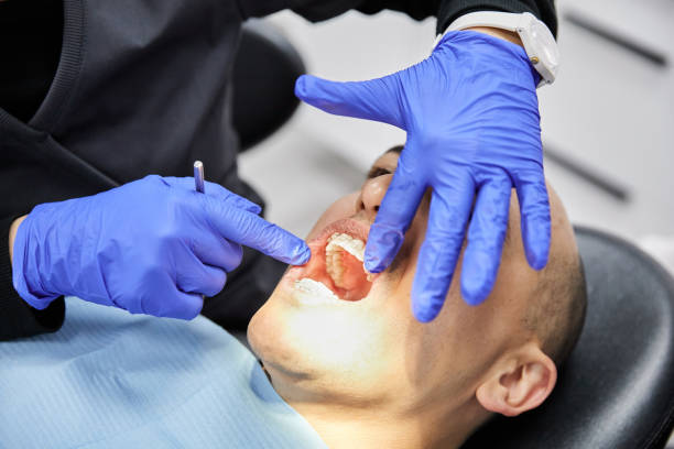 Best Emergency Denture Repair in Lake Barcroft, VA