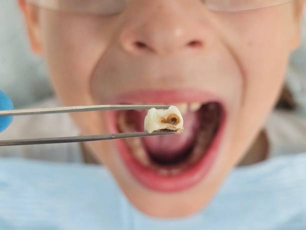 Best 24-Hour Emergency Dental Care in Lake Barcroft, VA