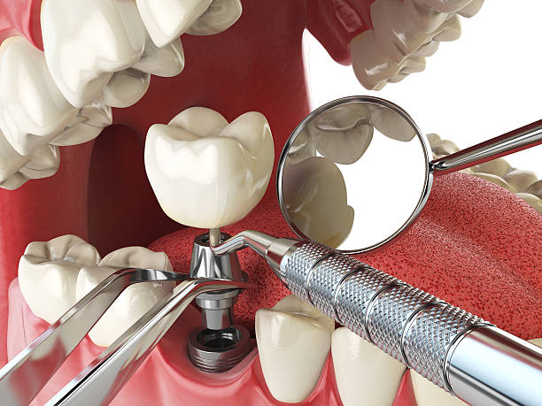 Best Emergency Treatment for Oral Infections in Lake Barcroft, VA
