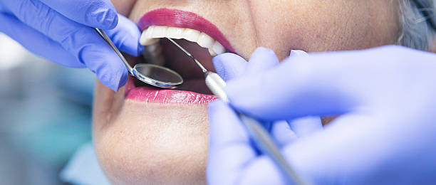 Best Urgent Dental Care for Toothaches in Lake Barcroft, VA