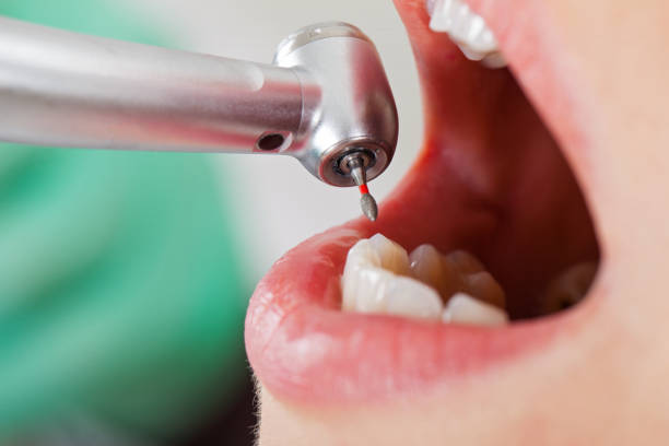 Best Emergency Orthodontic Repairs in Lake Barcroft, VA